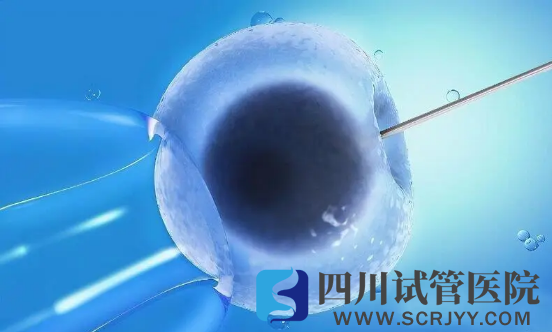 黃體期短效長方案優(yōu)點，卵巢不好的女性有救了(圖1)